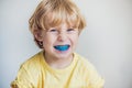 Three-year old boy shows myofunctional trainer to illuminate mouth breathing habit. Helps equalize the growing teeth and correct Royalty Free Stock Photo