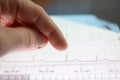 Thumb over tablet with heart cardiogram image