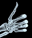 Thumb up with xray hand Royalty Free Stock Photo