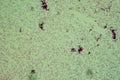Thyphus bacteria under the microscop Royalty Free Stock Photo