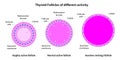 Thyroid Follicles of different activity: hyghly, normal and inactive.