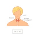 Thyroid gland anatomy of female