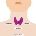 Thyroid gland front view on white background. Human body organ anatomy icon with description. Medical concept. Isolated vector Royalty Free Stock Photo