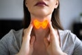 Thyroid Gland Salivary Disease. Woman Royalty Free Stock Photo