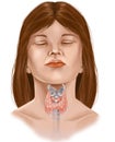 Thyroid