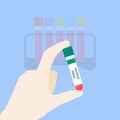 Thyroid panel test tubing Royalty Free Stock Photo