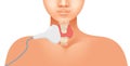 Thyroid ultrasound vector illustration. Linear array transducer is placed on the human neck Royalty Free Stock Photo