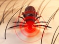 Tick bite Royalty Free Stock Photo