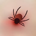 Tick bite on human scin. Realistic vector illustration