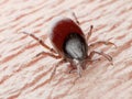 A tick biting Royalty Free Stock Photo