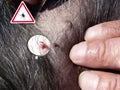 Tick on a black dog`s fur. Man looks with magnifying glass