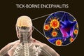 Tick-borne encephalitis concept