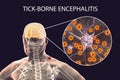 Tick-borne encephalitis concept