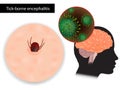 Tick-borne encephalitis. Viral infectious disease involving the central nervous system. Sheep ticks or Ixodes ricinus