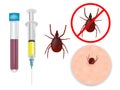 Tick-borne encephalitis vaccination.Tick bite protection Vaccination against ticks. Prevention of infections transmitted