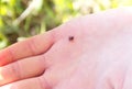 Tick crawls on human palm. Ixodes spreading tick-borne encephalitis and borreliosis. Danger human parasite