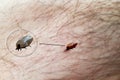 Tick crawls on the skin