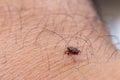 Tick filled with blood on human skin