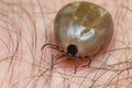 Tick filled with blood sitting on human skin