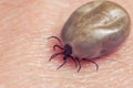 Tick filled with blood sitting on human skin