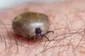 Tick filled with blood sitting on human skin