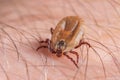 Tick filled with blood sitting on human skin