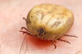 Tick filled with blood sitting on human skin