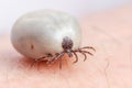 Tick filled with blood sitting on human skin