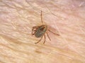 Tick on human hairy skin