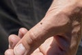 Tick on human hand. Ixodes ricinus. Parasitic mite. Dangerous insect mite. Encephalitis, Lyme disease infection