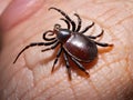a tick on a human\'s finger Royalty Free Stock Photo