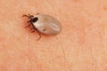 Tick on human skin