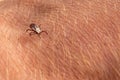 tick on human skin bites and carries disease Royalty Free Stock Photo