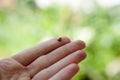 Tick on humans finger Royalty Free Stock Photo