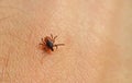 Tick Ixodes ricinus on human skin.