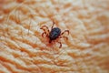 Tick on skin Royalty Free Stock Photo