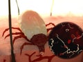 Tick biting and infecting with borrelia bacteria Royalty Free Stock Photo