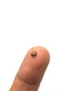 Ticks on Man Royalty Free Stock Photo