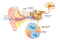 Tinnitus. Damaged hair cells inside cochlea Royalty Free Stock Photo
