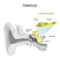 Tinnitus. Human ear Royalty Free Stock Photo