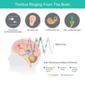 Tinnitus Ringing From The Brain, Is the term for a buzzing noise in your ears from symptoms abnormal in ears