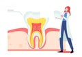 Tiny Dentist Female Doctor Character in Mask and White Robe Put Part of Enamel on Huge Tooth Cross Section View Royalty Free Stock Photo
