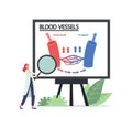 Tiny Doctor with Huge Magnifier in Hands Presenting Infographics of Blood Circulation in Vein, Artery Vessels of Heart