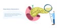 Tiny physician examines human pancreas with magnifier to diagnose its diseases. Medical observation flat vector banner