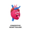 A tired and exhausted face on a heart or cardiac human body, representing congestive heart failure a chronic condition with