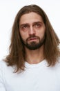 Tired Man With Exhausted Face And Dark Circles Under Eyes Royalty Free Stock Photo