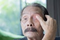 Tired old man scratching his eye feeling itch. Senior man suffer from tired dry irritated eyes or headache Royalty Free Stock Photo