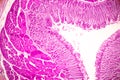 Small intestine Duodenum and Vermiform appendix Human under the microscope.