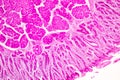 Small intestine Duodenum and Vermiform appendix Human under the microscope.