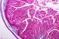 Tissue of small intestine or small bowel under the microscopic.
